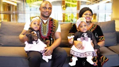 cameroonian-siamese-twins-found-healing-in-turkey