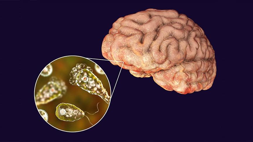 amoeba eating the human brain