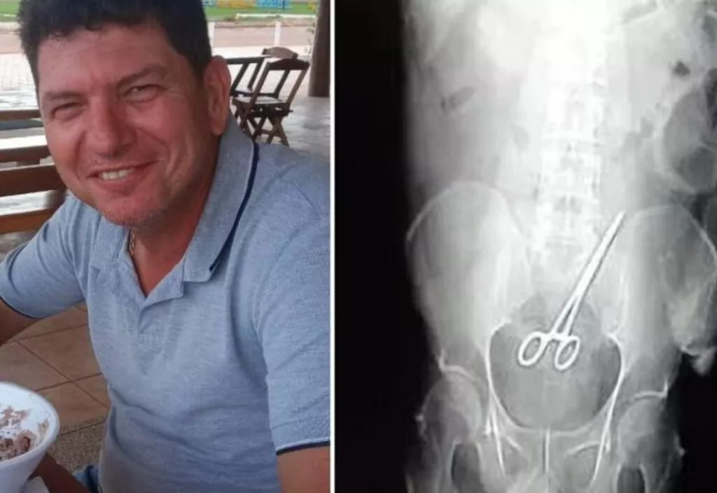 They Scissors In The Surgery! » Expat Guide Turkey